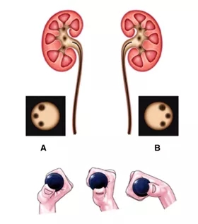 输尿管镜都有哪些公司【镜无止境】输尿管软镜操作的步骤和窍门_https://www.jmylbn.com_新闻资讯_第2张