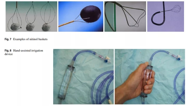 输尿管镜都有哪些公司【镜无止境】输尿管软镜操作的步骤和窍门_https://www.jmylbn.com_新闻资讯_第7张